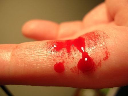 FREQUENZA CARDIACA ED EMORRAGIA. Contributo del sito Em Dose - https://emdose.wordpress.com/